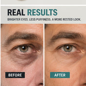 Rescue Eye Serum — Peptide Eye Treatment Gel for Men LATHR Made In Canada